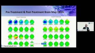 How Neurofeedback Improves Brain Functioning amp Reduces Autism Symptoms [upl. by Inalem]