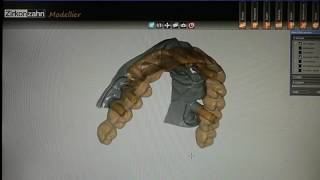 Zirkonzahn system implant type screw retained full arch Prettau [upl. by Merton]