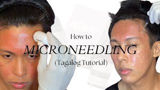 How to Microneedling Tagalog using New Skin New Me  Acne Scar Repair Kit by TCC [upl. by Enomes350]