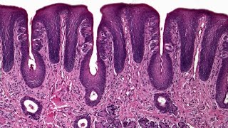 Circumvallate papillae  practical Histology [upl. by Nohj]