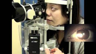 Part 3 Using a Slit Lamp [upl. by Nayr]