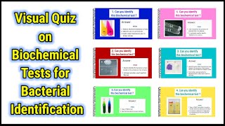 Visual Quiz on Biochemical tests for identification of bacteria  basicappliedmicrobiology [upl. by Okimuk]