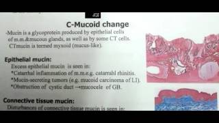 hyaline and mucoid change [upl. by Grimes]