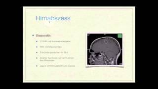 Basiskurs Neurologie Entzündliche Erkrankungen Teil 814 [upl. by Norraa123]