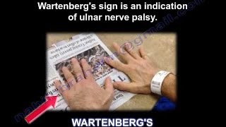 Wartenbergs Sign  Everything You Need To Know  Dr Nabil Ebraheim [upl. by Sherourd290]