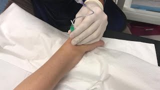 IntraArticular Injection of the Wrist Under Fluoroscopic Guidance [upl. by Jacintha]