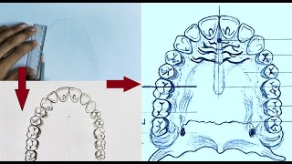 Anatomical Landmarks of Maxilla [upl. by Nnarefinnej]