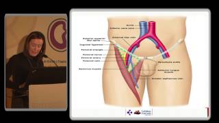 🥇 ARTERIA FEMORAL Anatomía ¡Explicación Fácil y Sencilla [upl. by Nylacaj]