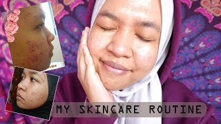 MY SKINCARE ROUTINE FOR OILY amp ACNE PRONE SKIN [upl. by Rramahs]