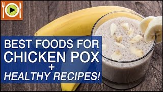 Best Foods for Chicken Pox  Healthy Recipes [upl. by Colon711]