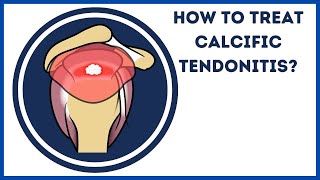 How to treat calcific tendonitis [upl. by Amrak]