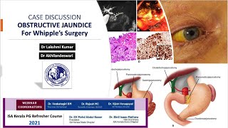 Obstructive jaundice for Whipples surgery  Case Discussion  Kerala ISA PG Refresher Course 2021 [upl. by Ennayt650]