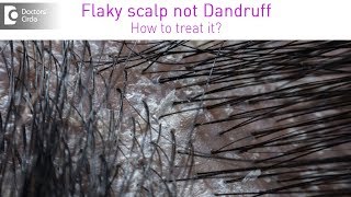 Get rid of itchy white flaky scalp which is not dandruff  Dr Rashmi Ravindra Doctors Circle [upl. by Aicnilav]