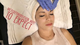 Microdermabrasion 101 What to expect [upl. by Grizelda162]