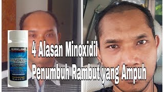 Alasan Minoxidil adalah penumbuh rambut yang Ampuh [upl. by Gamali]