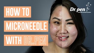 How to microneedle at home with Dr Pen  Dr Pen Australia  Microneedling  Skin Needling  CIT [upl. by Geraud]