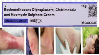 QUADRIGOOD Cream Bepomethasone Dipropionate Clotrimazole and Neomycin Sulphate Cream [upl. by Kavanaugh386]