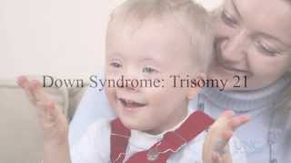 Down Syndrome Trisomy 21 Screening [upl. by Anilek790]