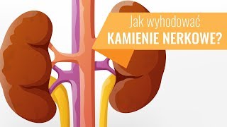 Jak wyhodować sobie kamienie nerkowe [upl. by Asel410]