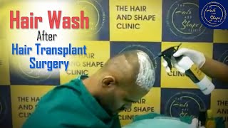 Hair Wash After Hair Transplant surgery at The Hair And Shape Clinic Malad Mumbai [upl. by Ttennaej]