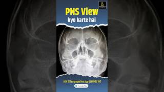 PNS View Xray  Pns view kyo karte hai  pns xray xraytechnicians pnsview drtclasses shorts [upl. by Drawyeh]