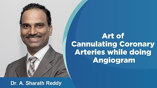 Art of Cannulating Coronary Arteries while doing Angiogram  Medicover Hospitals [upl. by Golding]