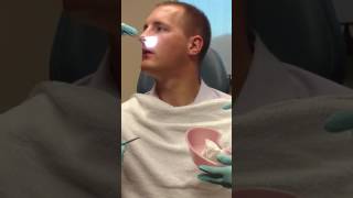 Septoplasty and Turbinate Reduction Splint Removal [upl. by Ylevol922]