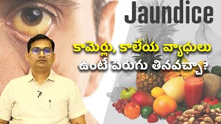 Jaundice and Liver Disease Treatment Food  కామెర్లు కాలేయ వ్యాధులు ఉంటే పెరుగు తినవచ్చా [upl. by Leirza634]