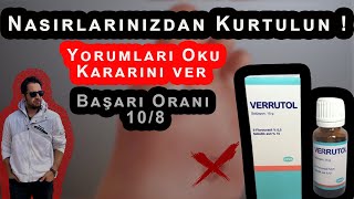 Nasırı Verrutol Yöntemiyle Geçirme \u00100 Çözüm [upl. by Arual724]