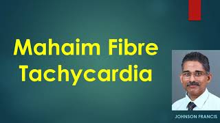 Mahaim Fibre Tachycardia [upl. by Lynsey]