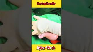 loudly crying newborn 🥰 baby after birth Ep39 loudly crying littlebabyvideo1 [upl. by Aynor]