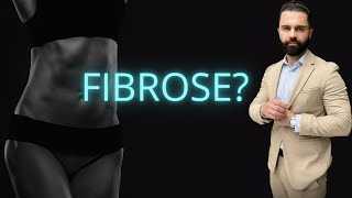 4 DICAS PARA EVITAR A FIBROSE APÓS A LIPO [upl. by Aisad]