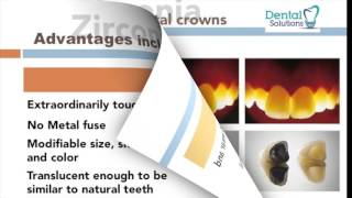 Zirconia crowns vs Porcelain Metal Crowns PMC [upl. by Gean312]