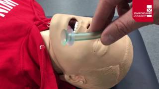 Nasopharyngeal Airway Insertion [upl. by Seligmann399]