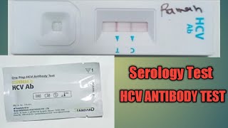 HepatitisC Antibody Test  Serology  HCV TEST  viral marker [upl. by Shargel]