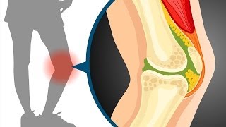 Sliding filament theory in muscle contraction  Wellcome [upl. by Oika]