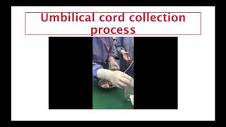 Umbilical cord collection for stem cell culture [upl. by Akinor638]