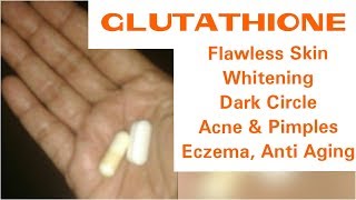 GLUTATHIONE Skin Whitening Treatment Dark Circle त्वचा के गोरेपन के लिये इलाज Eczema Treatment [upl. by Goodson]