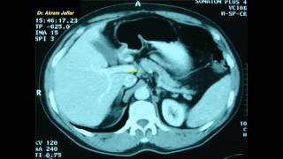 Cross sectional and imaging anatomy of the abdomen [upl. by Aneres]