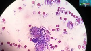 leishmania under the microscope  leishmaniose  الليشمانيا [upl. by Eanej]