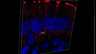 Listeria monocytogenes in Mouse Ileal Tissue [upl. by Robet394]