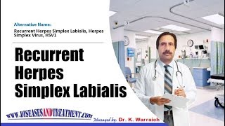 Recurrent Herpes Simplex Labialis  Causes Diagnosis Symptoms Treatment Prognosis [upl. by Aderb]