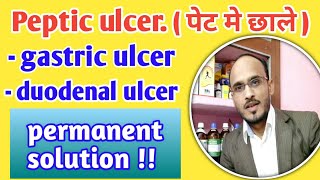 Pepticulcergastric ulcerduodenal ulcerhomeopathic treatmentpepticulcer symptoms cause treatment [upl. by Tugman]