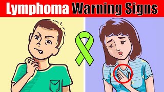 7 Warning Signs of Lymphoma You Shouldnt Ignore [upl. by Birk]