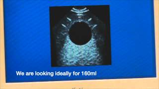 Bladder Scanner Calibration Tutorial from WinHealthcom [upl. by Darees]