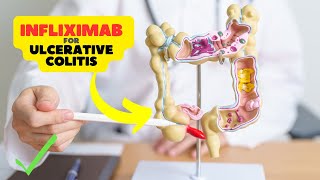 Infliximab Side Effects Safeguarding Health in Crohns Disease and Ulcerative Colitis [upl. by Uhej]