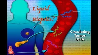 Liquid Biopsy Spots Cancers in Blood [upl. by Nnairret]