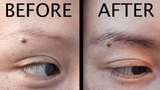 How to grow Thicker Eyebrows damaged from plucking [upl. by Aielam999]