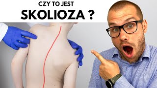 SKOLIOZA  wszystko co musisz wiedzieć [upl. by Anitsyrc18]