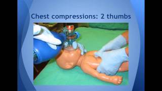 Resuscitation of Newborn Infants [upl. by Gifford]